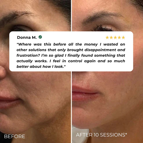 Levana SculptLift™