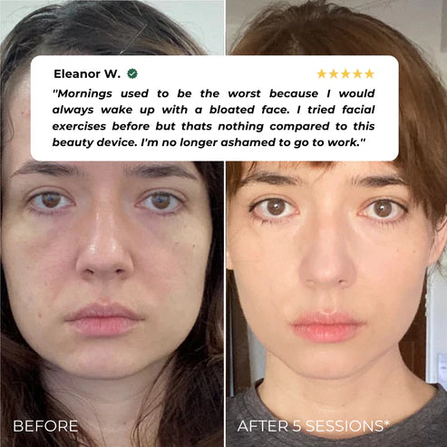 Levana SculptLift™