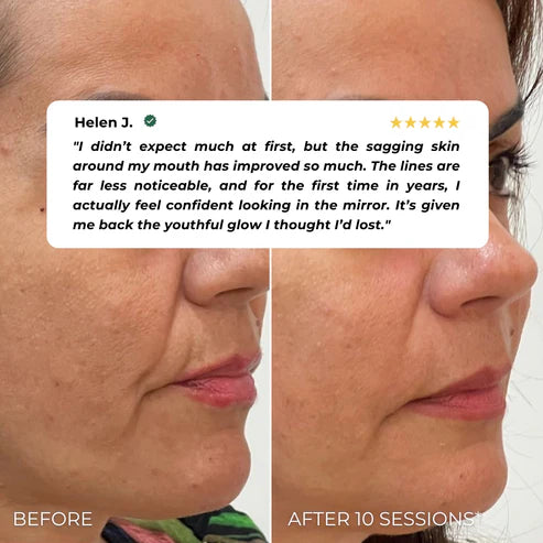 Levana SculptLift™