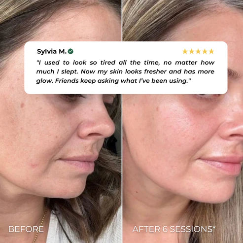 Levana SculptLift™