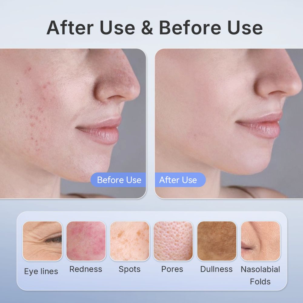 Kamira | LED Face Mask — Quad-Wavelength LED Light Home Use Device