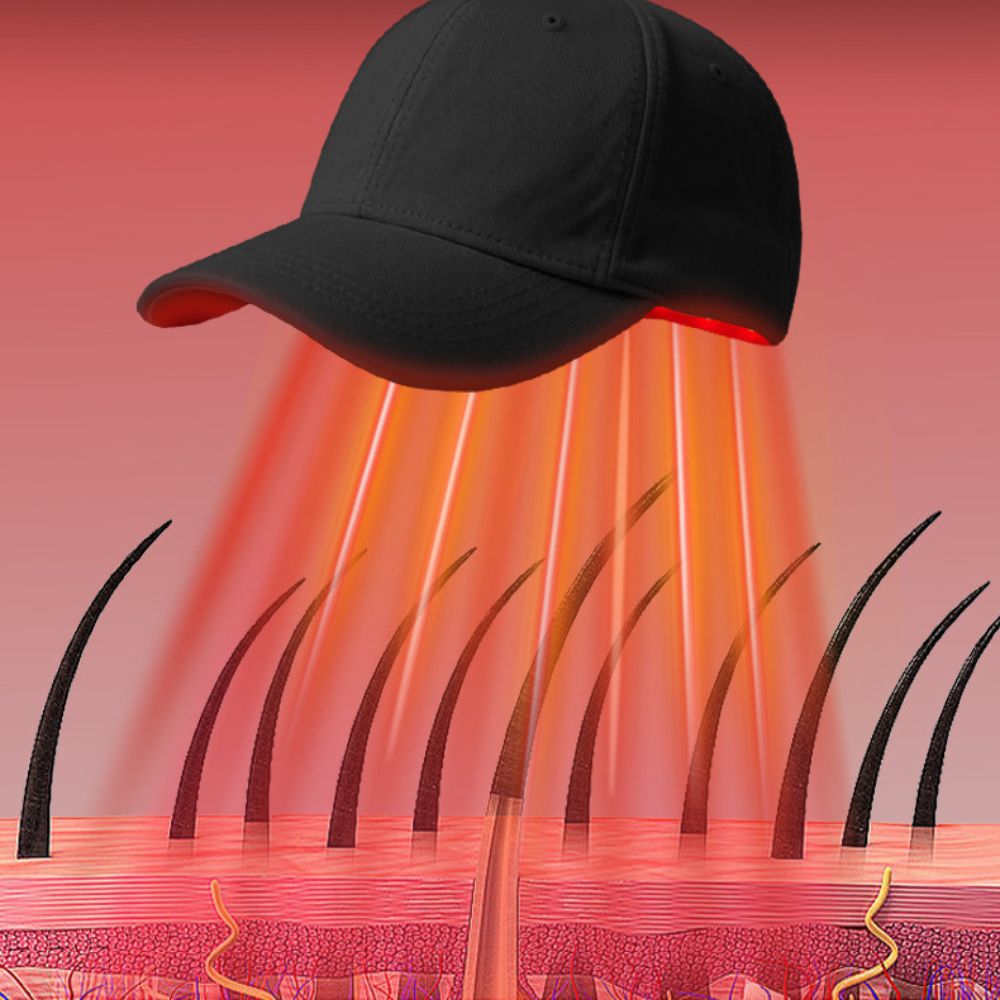 Nodara | Red Light LED Cap — Advanced 650nm LED Scalp Home Use Device