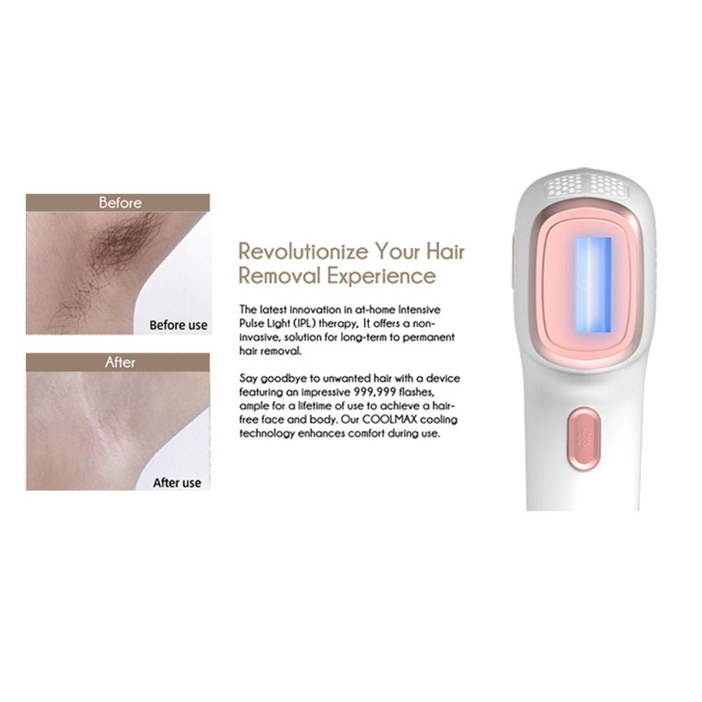 Novira | 810nm Laser Hair Removal Machine — Wide-Angle Home Use Device