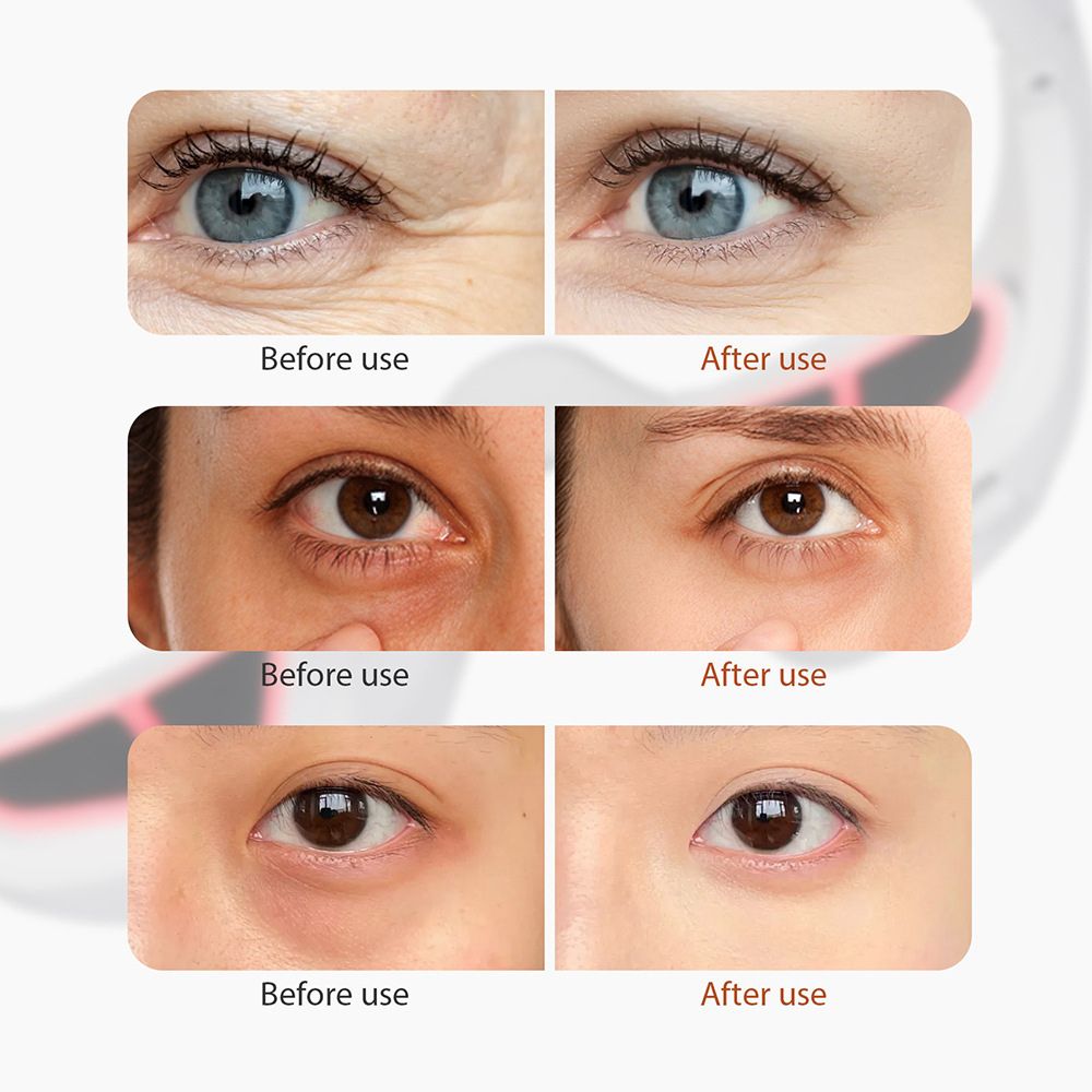 Elrana | Eye Massager Mask — Rechargeable Portable LED Eye Care Device