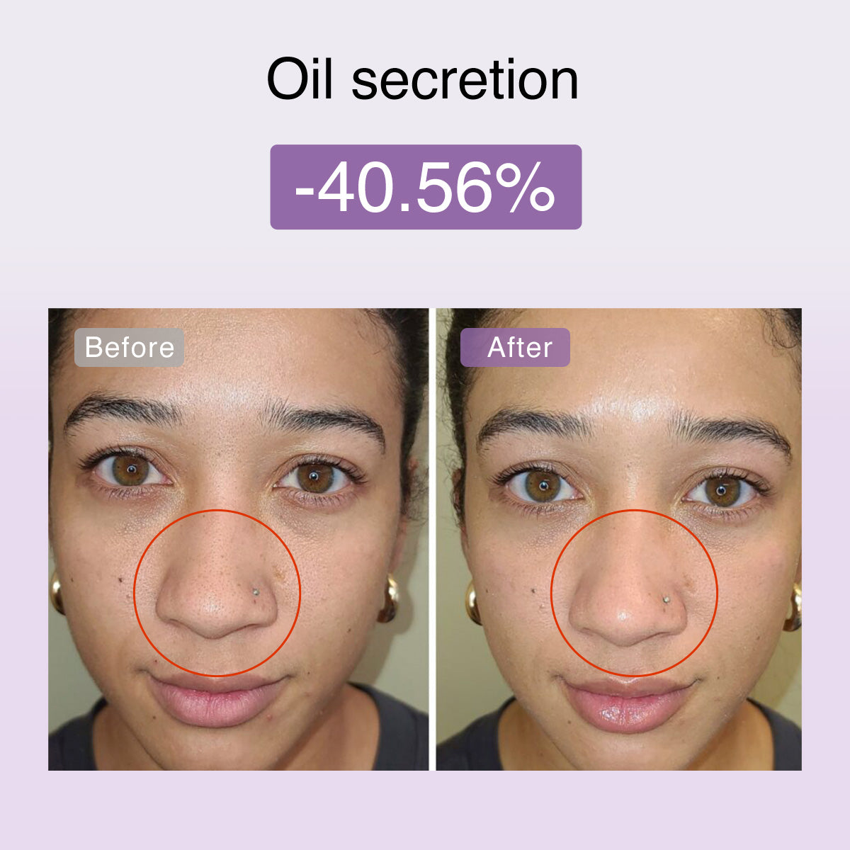 Auryn | Microcurrent Facial Toning Device — Compact Multi-Technology Rechargeable Home Use 6