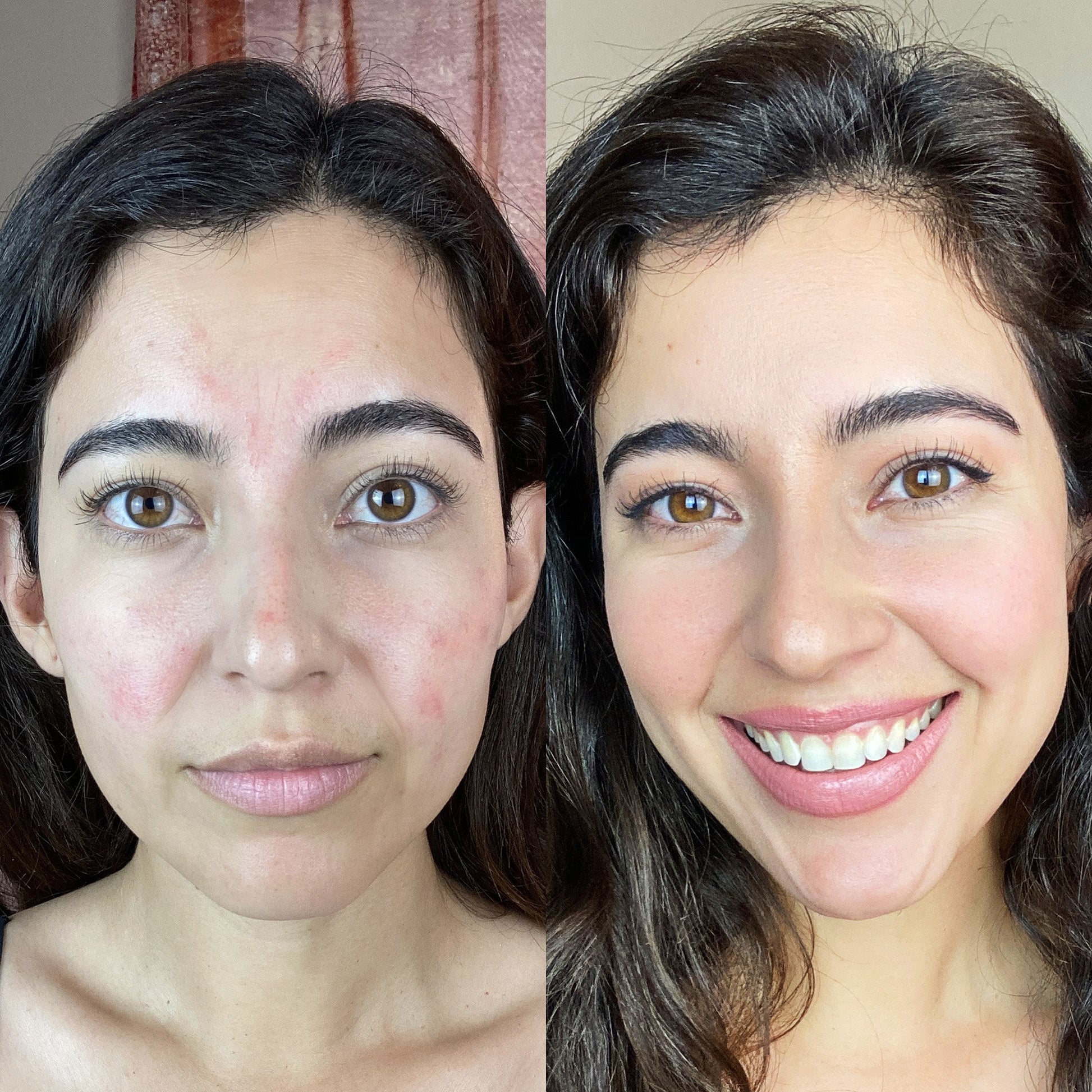 Lumex | Chin & Neck Tightening Device — Multispectral Light EMS Rechargeable Home Use 3