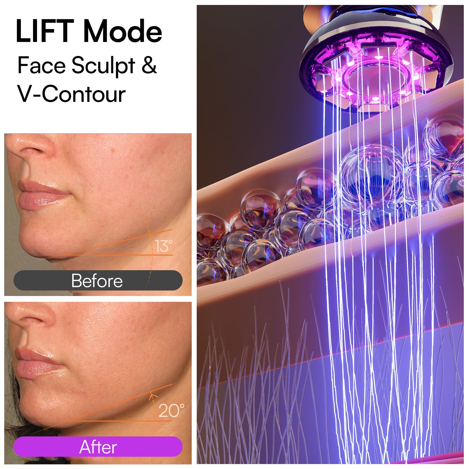 Lumex | Microcurrent Facial Device — Portable Rechargeable Beauty Tool 3