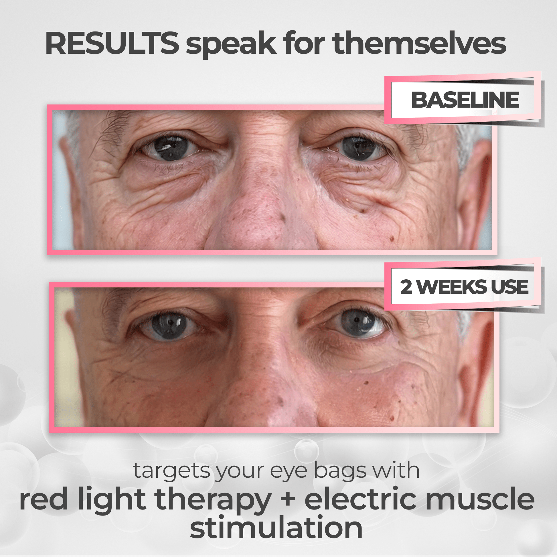 Luminara | Eye Massager Mask — Rechargeable Portable LED Eye Care Device 1
