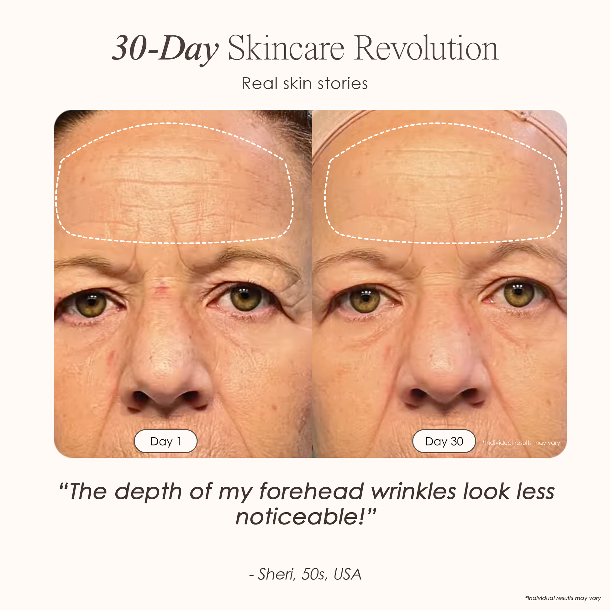 Luminara | LED Face Mask — Advanced Multi-Wavelength Light Therapy Device 2