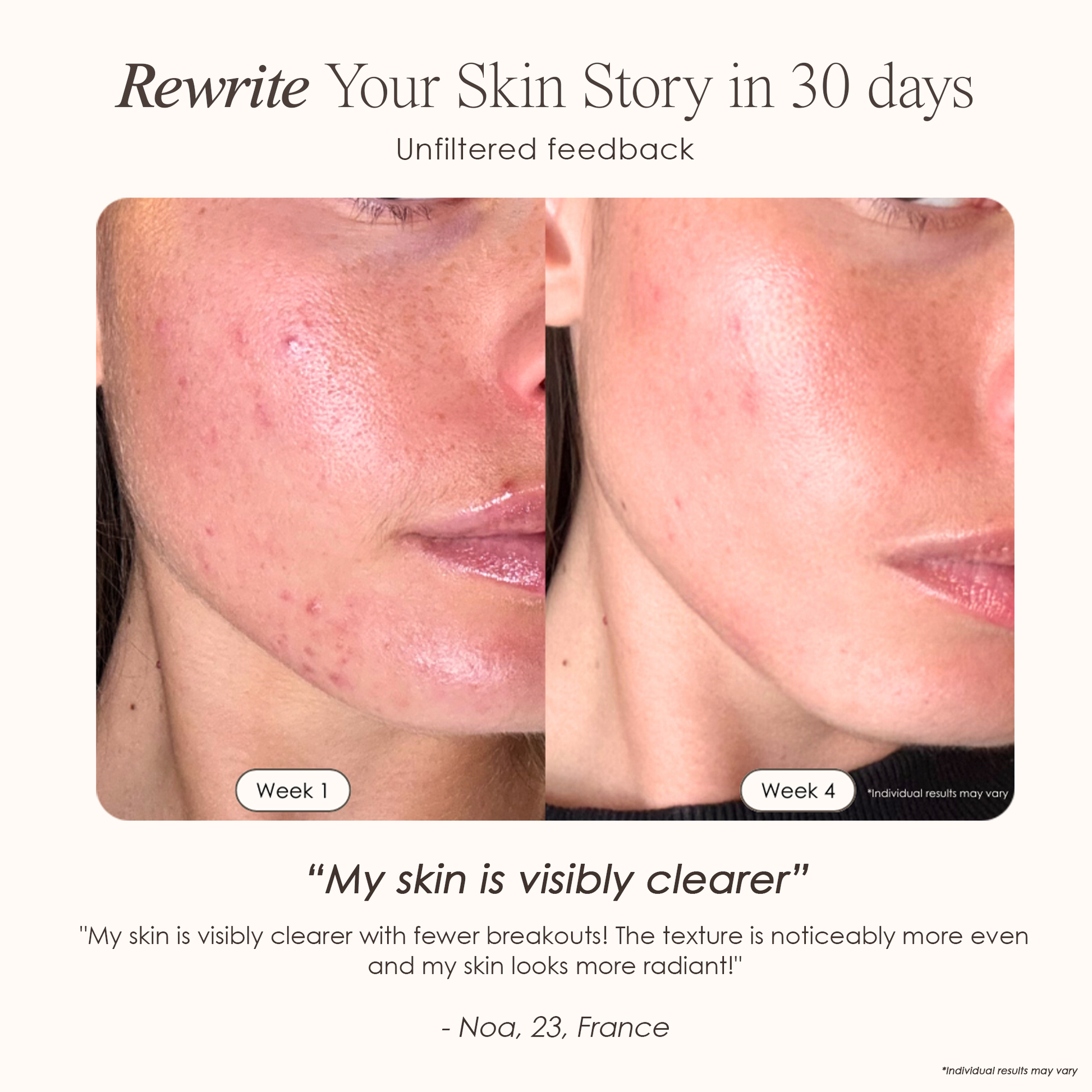 Luminara | LED Face Mask — Advanced Multi-Wavelength Light Therapy Device 3
