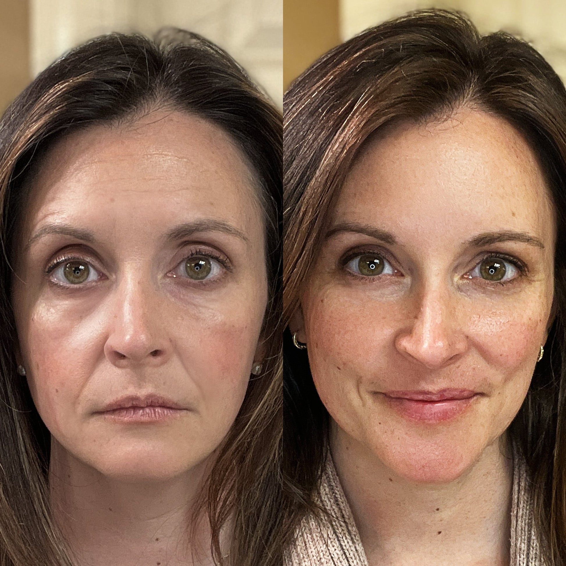 Luminara | LED Face Mask — Rechargeable Full Coverage Red Light Technology 5