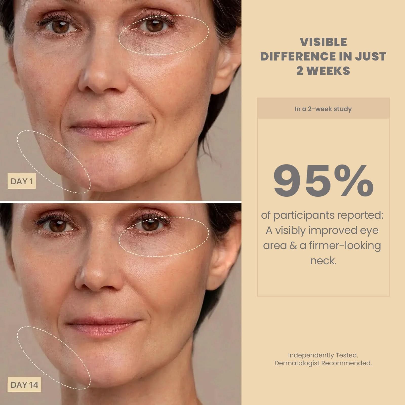 Lunara | Face Sculpting Tool — Advanced RF Rechargeable Facial Massage Device 2
