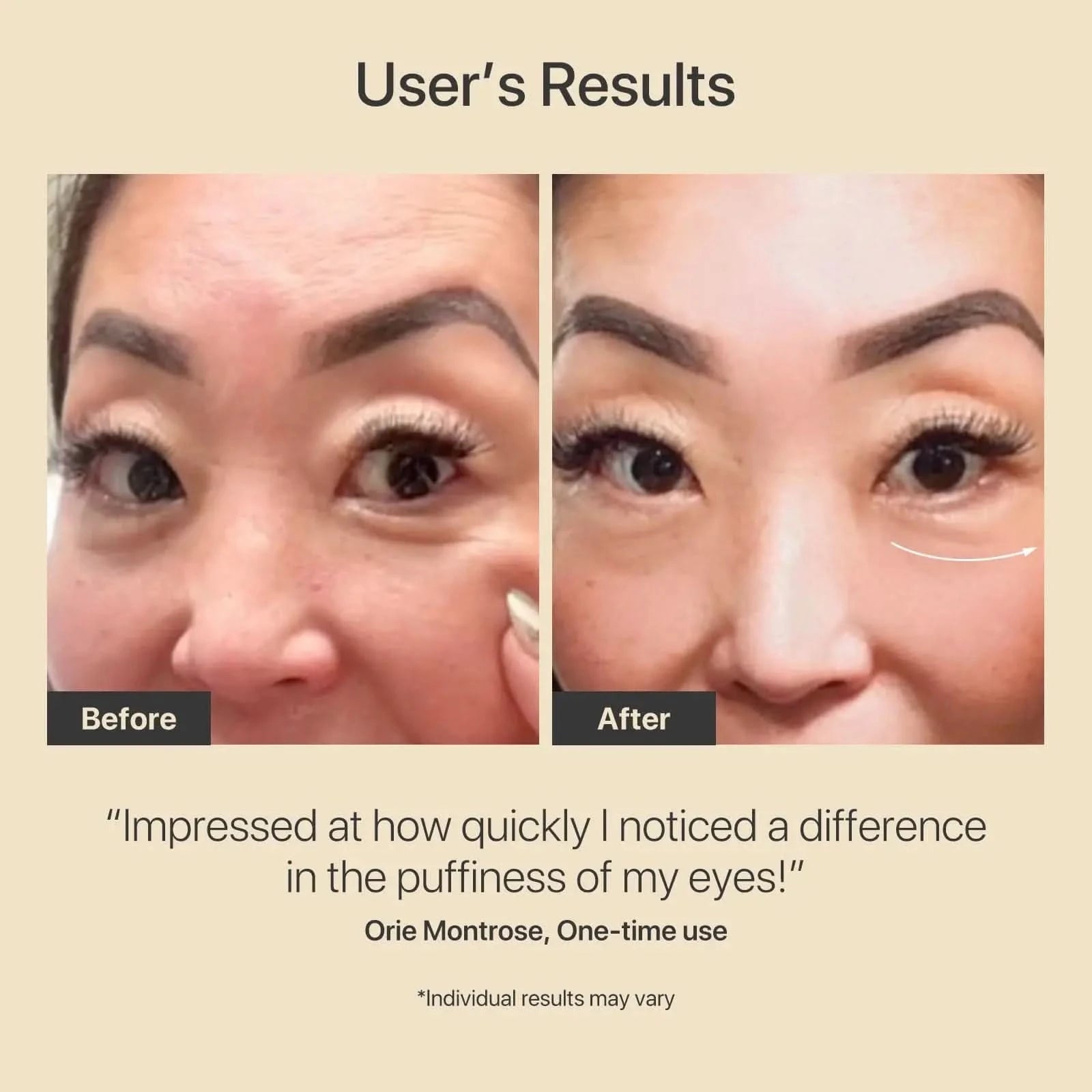 Lunara | Face Sculpting Tool — Advanced RF Rechargeable Facial Massage Device 3