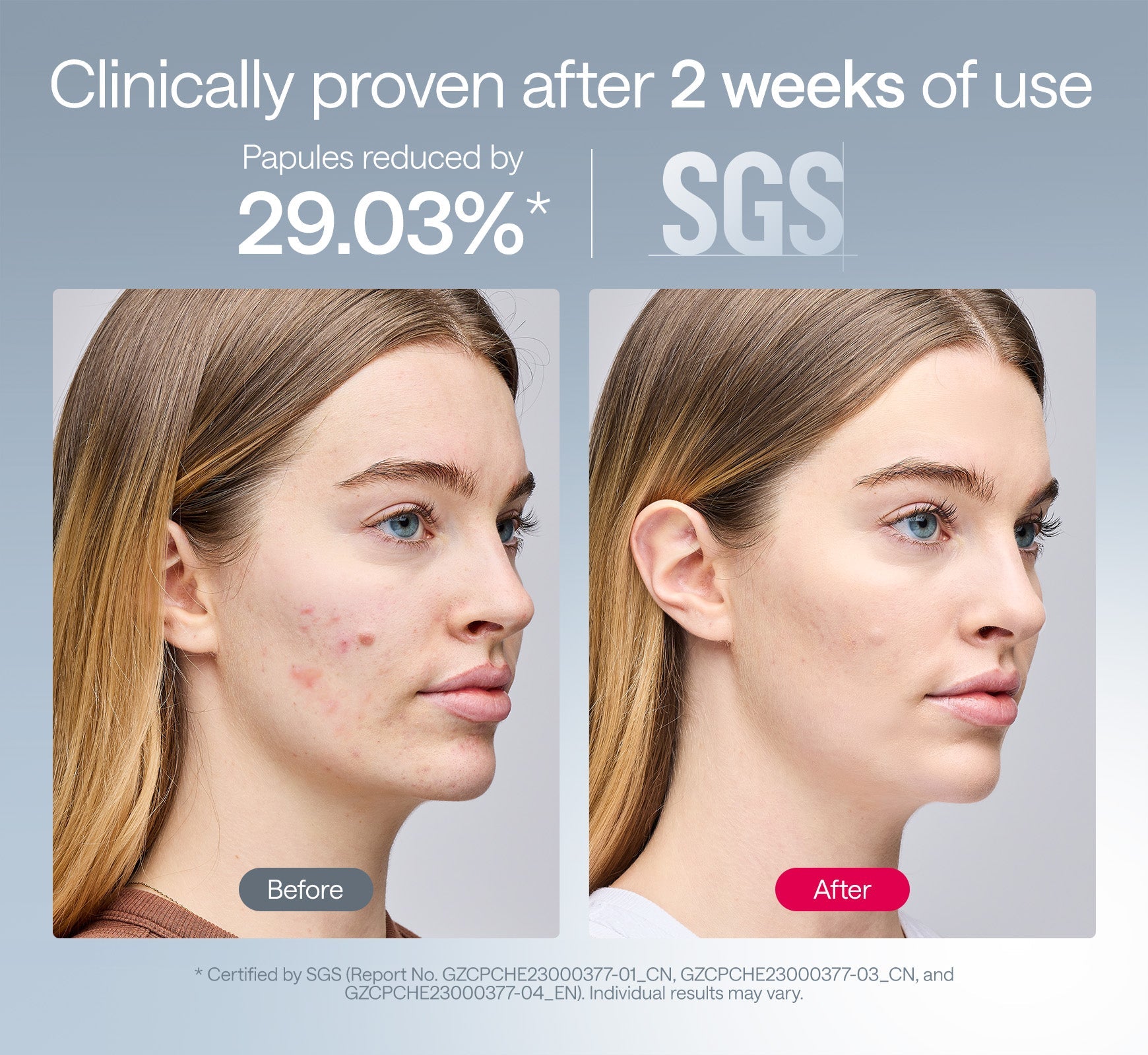 Solara | LED Skin Renewal Mask — Advanced 360° Coverage Rechargeable Device 6