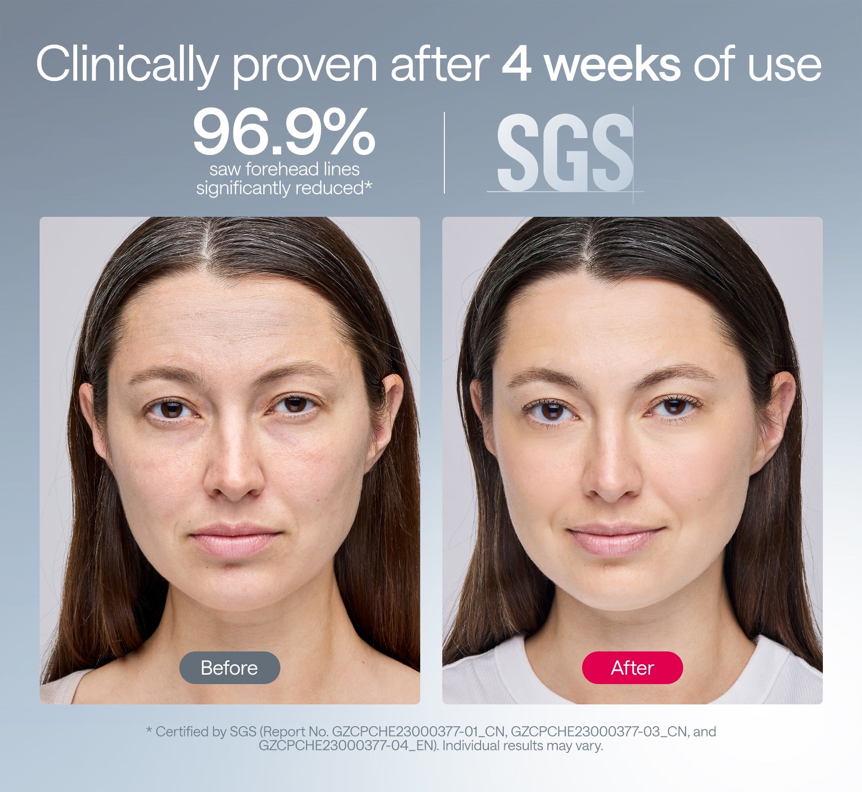 Solara | LED Skin Renewal Mask — Advanced 360° Coverage Rechargeable Device 7