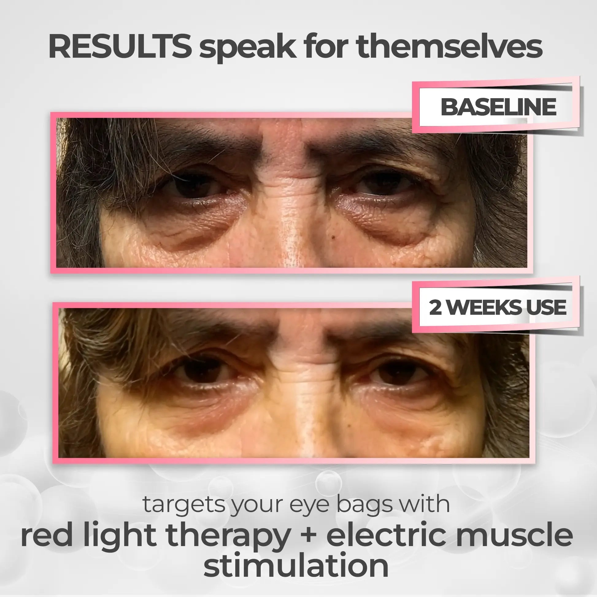 Zephira | Eye Massager Mask — Rechargeable Red Light EMS Technology 1