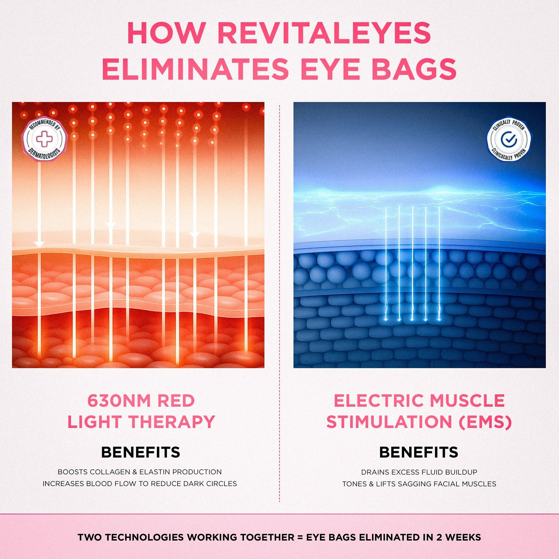 Zephira | Eye Massager Mask — Rechargeable Red Light EMS Technology 6
