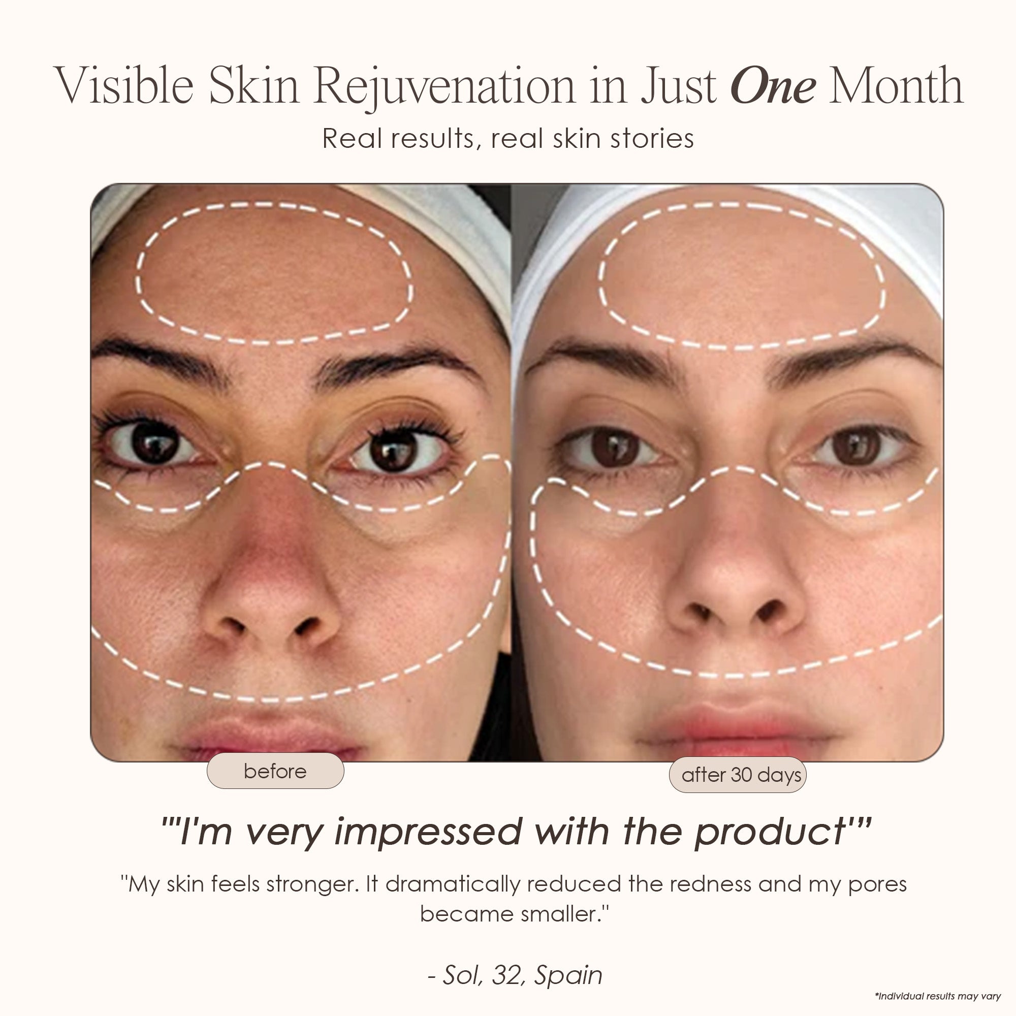 Zephira | LED Face Mask — Multi-Wavelength Portable Skincare Device 2