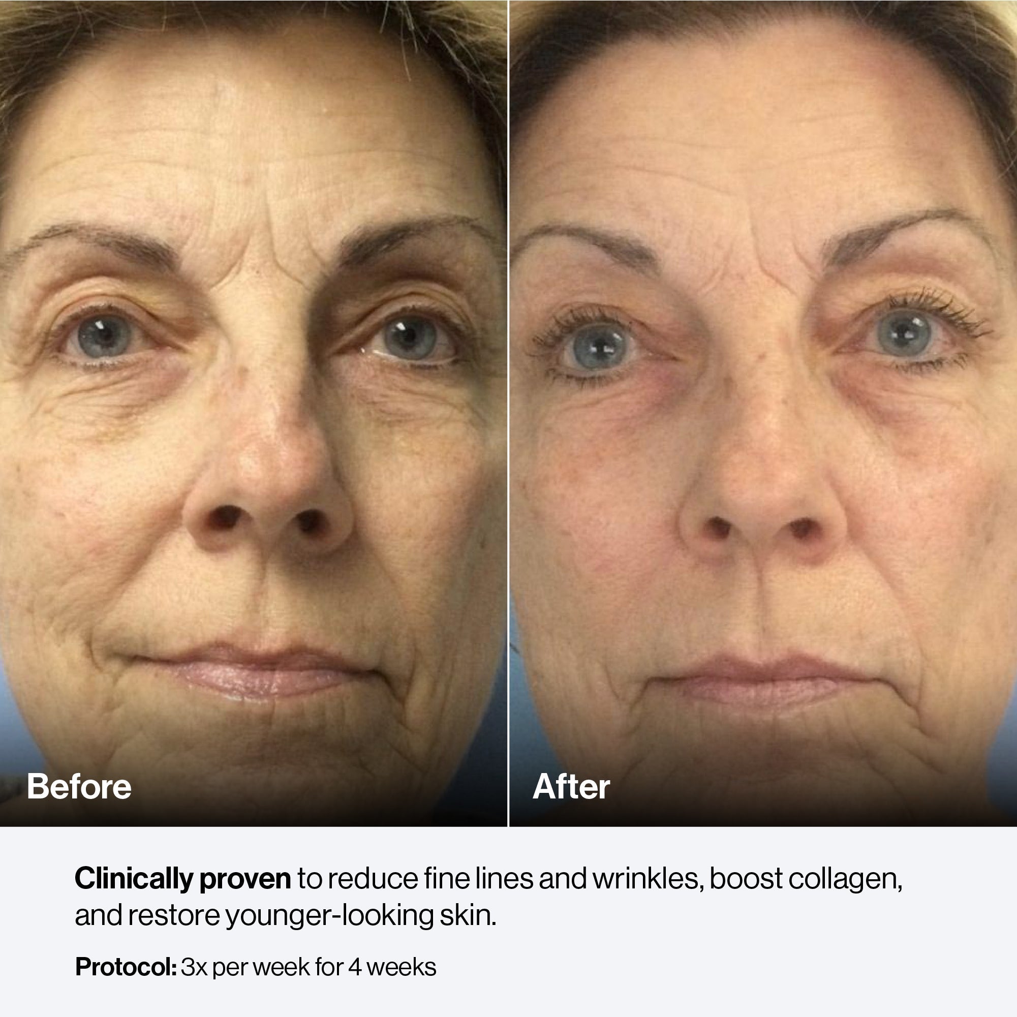 Zephira | LED Light Therapy Panel — Portable Large Single-Panel Rechargeable Device 4
