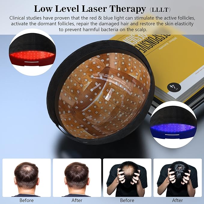 Zephira | Laser Hair Growth Cap — Dual Mode Low-Intensity Laser Technology 2