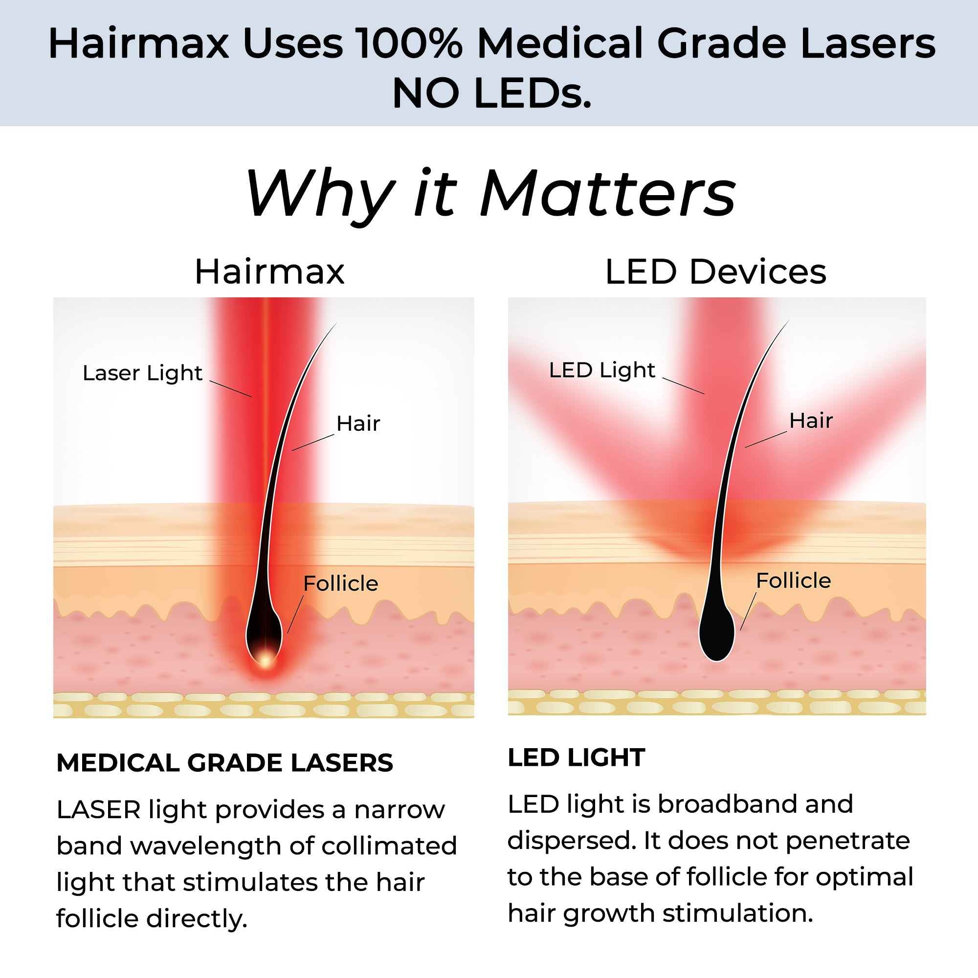 Zephira | Laser Hair Growth Cap — Portable Advanced Laser Light Technology 2