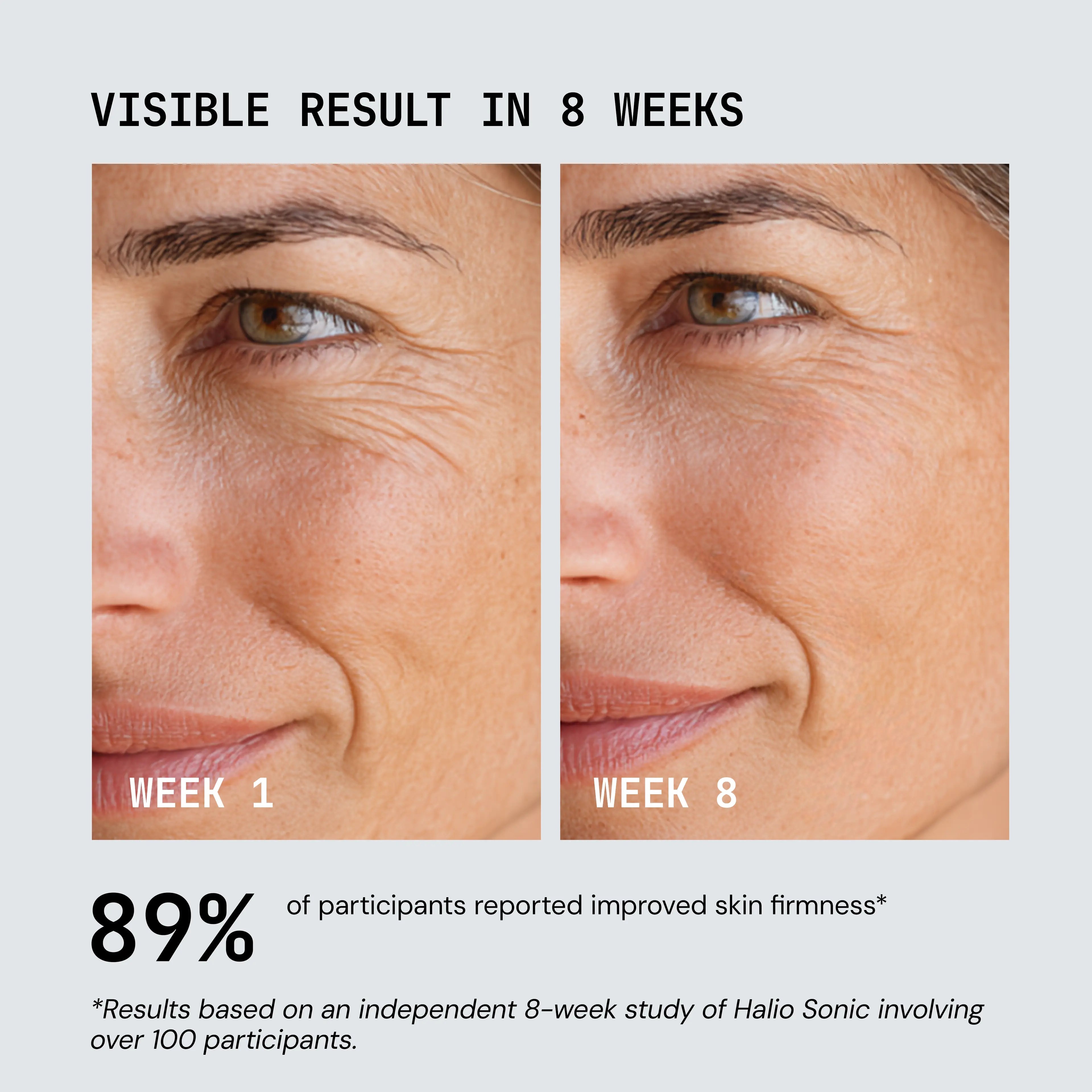 Zephira | Skin Rejuvenator Device — RF and EMS Technology with Multiple Light Options 7