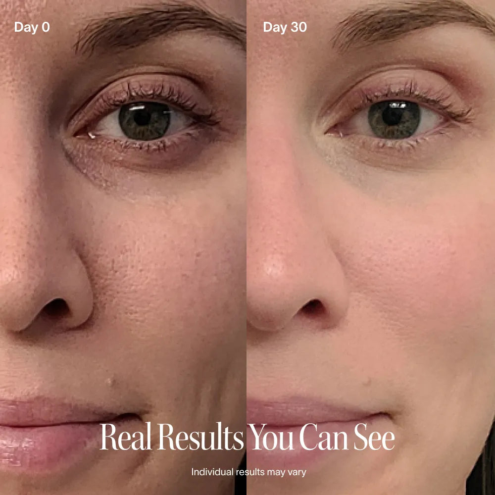 Zephira | Skincare Wand — Portable Red Light Technology with Rotating Head 8